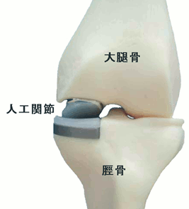 knee_01