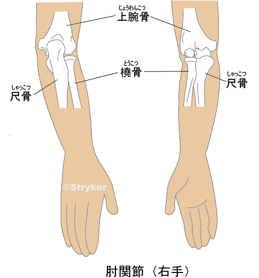 肘関節肉付